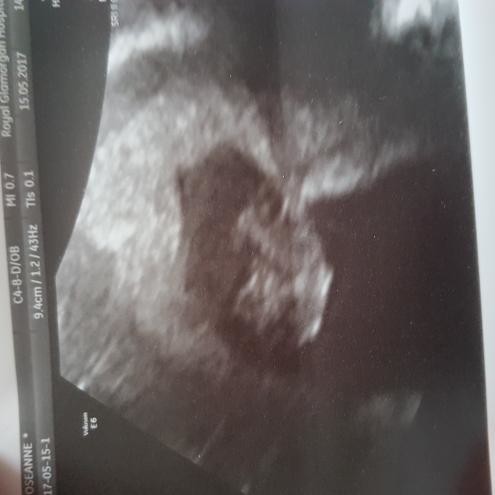 7 week scan pics anyone?