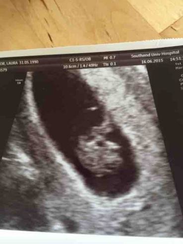 What's the earliest you can see a baby on a scan?