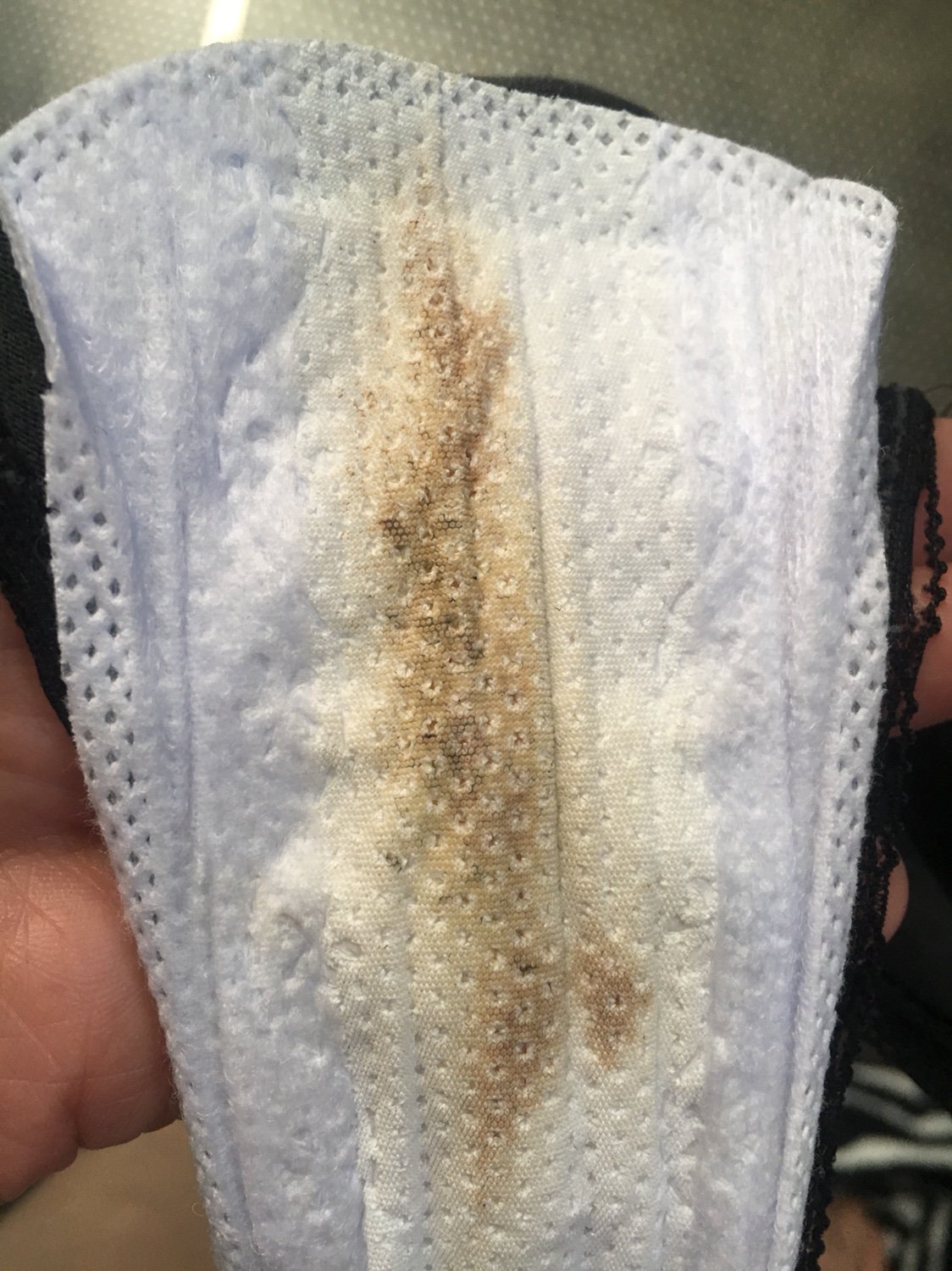 TMI - small brown spot on underwear, 2-3 weeks pregnant -- anyone with  experience? - 1st Pregnancy, Forums