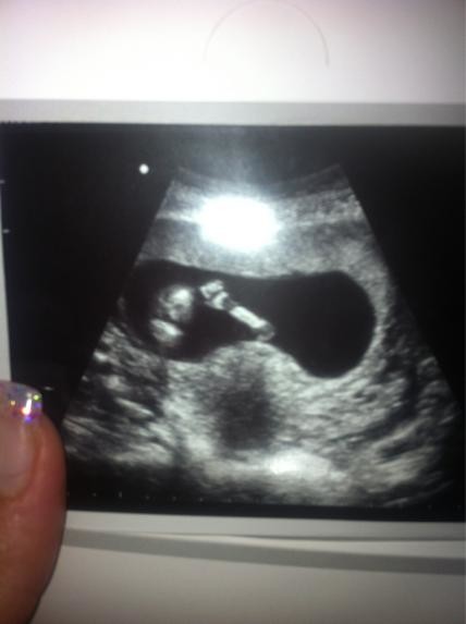 12 WEEK SCAN!