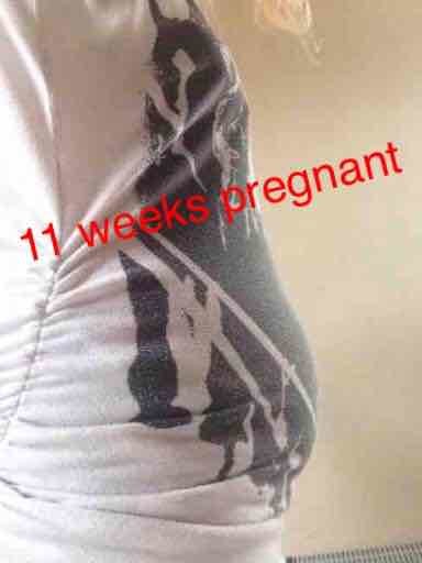 11-weeks-tummy-s