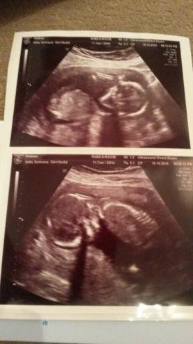 12 weeks today belly bump pics...share yours at 12 weeks