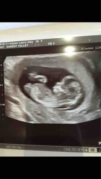 12 Weeks From Today Would Be 12 weeks today belly bump pics...share yours at 12 weeks