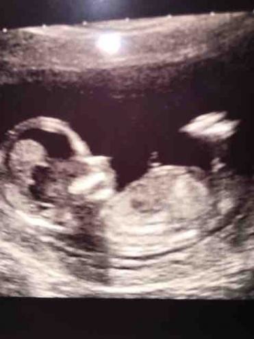 Any 12 week scans girls?!