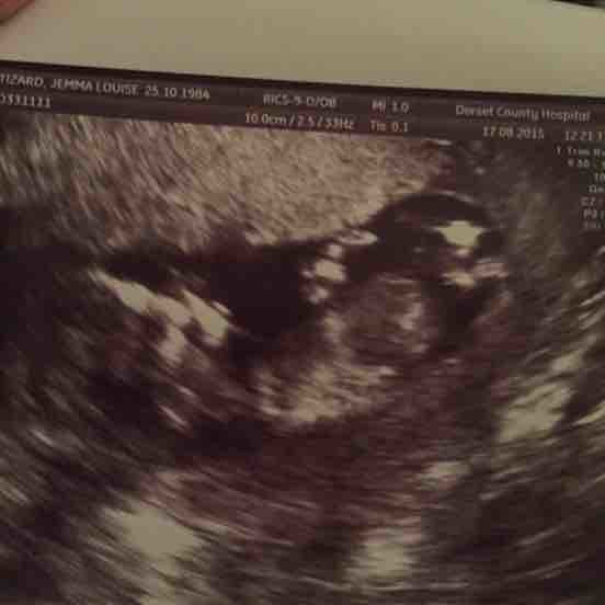 Any 12 week scans girls?!