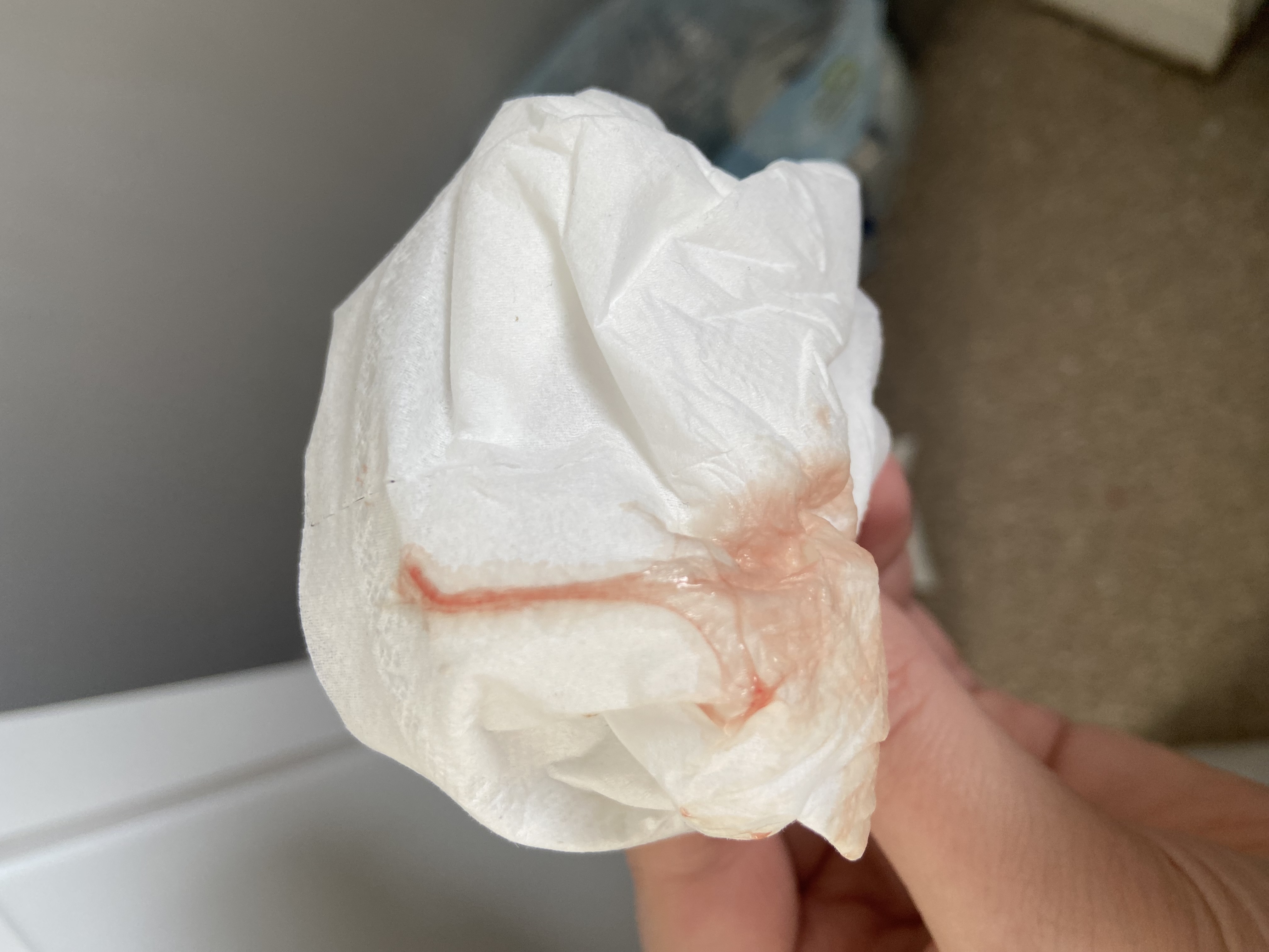 Could this be implantation bleeding? (TMI pics)