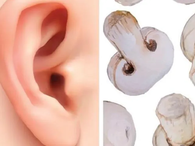 Les champignons et les oreilles