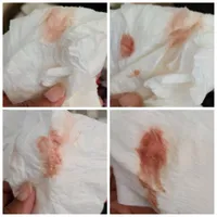 what does brown implantation bleeding look like on a pad
