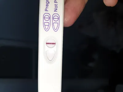 Discharge Before Period vs Early Pregnancy